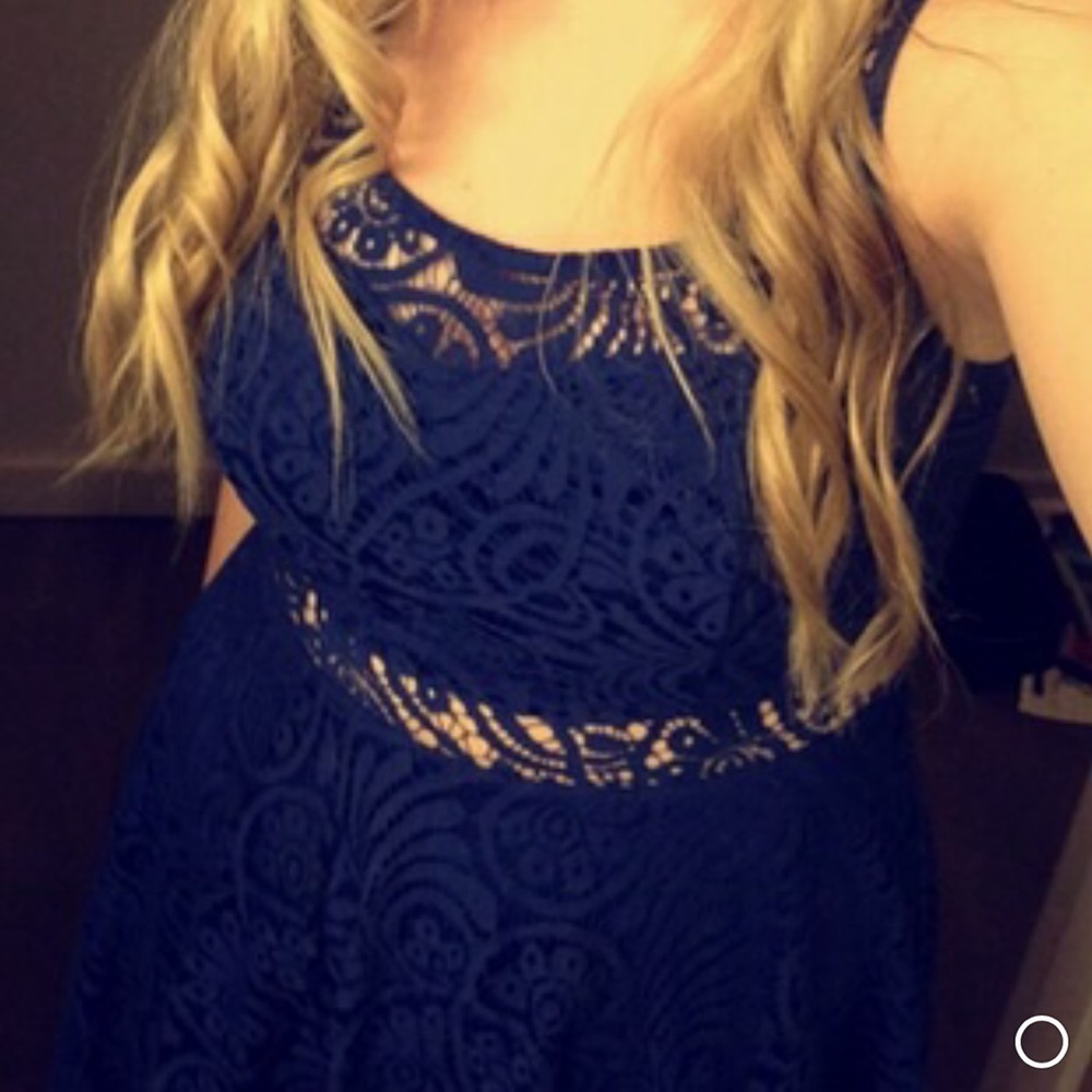 mini lace dress